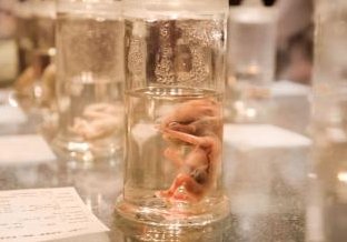 天津和睦家医院试管婴儿好吗？